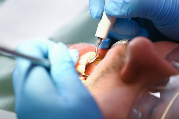 Best Emergency Treatment for Oral Infections in Mabank, TX